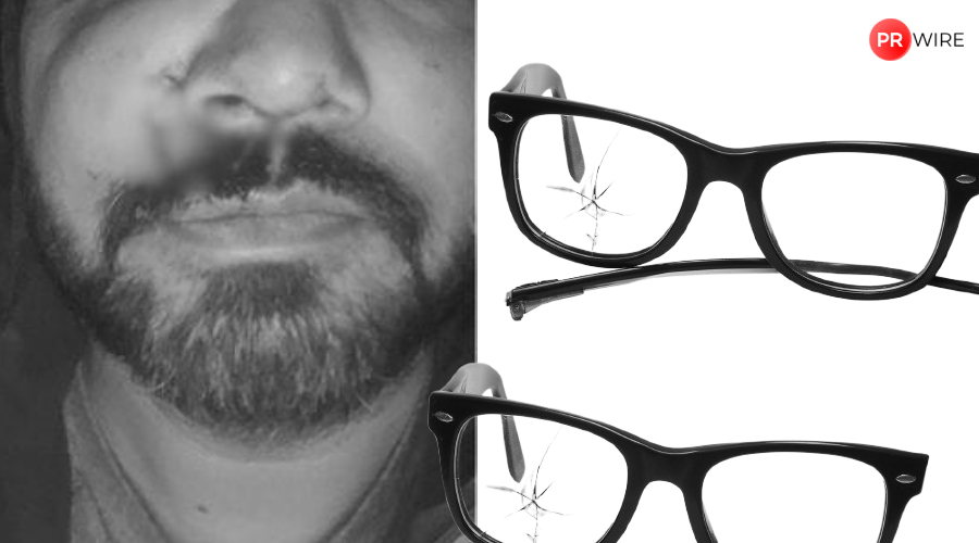 Indian-origin entrepreneur left with fractured cheekbone after ‘unprovoked racist’ attack by teenagers in Ireland