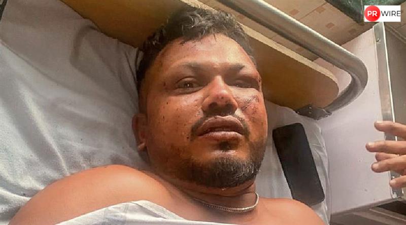 Son ignored, 'need wife's help for shower'_ Sole survivor of Air India crash struggles with unbearable trauma